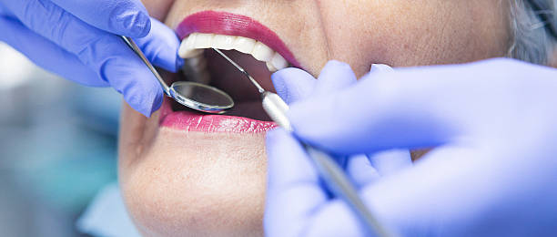 Best Urgent Care for Lost Fillings or Crowns in South St Paul, MN